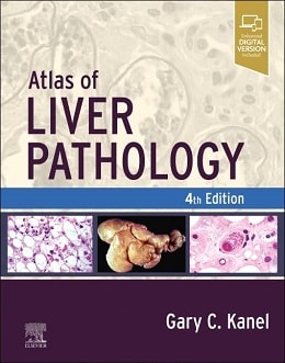 دانلود کتاب Atlas of Liver Pathology, 4ed
