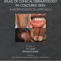 دانلود کتاب اطلس درماتولوژی بالینی در پوست رنگی: یک رویکرد مورفولوژیکی<br>Atlas of Clinical Dermatology in Coloured Skin: A Morphological Approach, 1ed