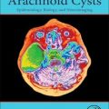دانلود کتاب کیست آراکنوئید: اپیدمیولوژی، زیست شناسی و تصویربرداری عصبی<br>Arachnoid Cysts: Epidemiology, Biology, and Neuroimaging, 1ed