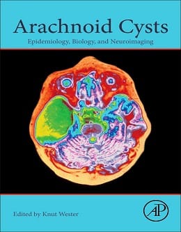 دانلود کتاب Arachnoid Cysts: Epidemiology, Biology, and Neuroimaging, 1ed