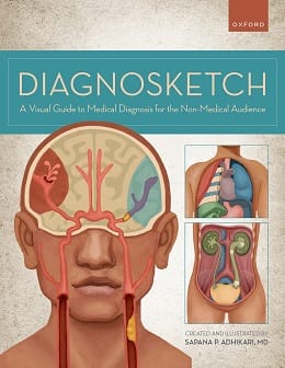 دانلود کتاب Diagnosketch: A Visual Guide to Medical Diagnosis for the Non-Medical Audience, 1ed