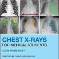 دانلود کتاب رادیوگرافی قفسه سینه برای دانشجویان پزشکی<br>Chest X-Rays for Medical Students, 2ed