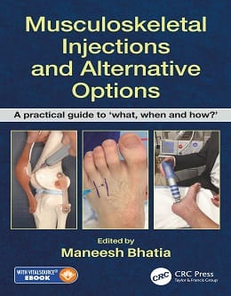دانلود کتاب Musculoskeletal Injections and Alternative Options, 1ed