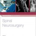 دانلود کتاب جراحی اعصاب ستون فقرات<br>Spinal Neurosurgery, 1ed