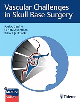 دانلود کتاب Vascular Challenges in Skull Base Surgery, 1ed