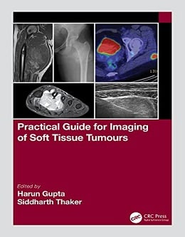 دانلود کتاب Practical Guide for Imaging of Soft Tissue Tumours, 1ed