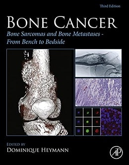 دانلود کتاب Bone Cancer: Bone Sarcomas and Bone Metastases - From Bench to Bedside, 3ed