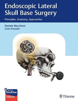 دانلود کتاب Endoscopic Lateral Skull Base Surgery, 1ed + Video