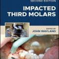 دانلود کتاب مولرهای نهفته سوم، ویرایش دوم<br>Impacted Third Molars, 2nd Edition