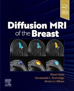 دانلود کتاب Diffusion MRI of the Breast, 1ed