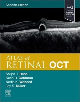 دانلود کتاب Atlas of Retinal OCT: Optical Coherence Tomography, 2ed