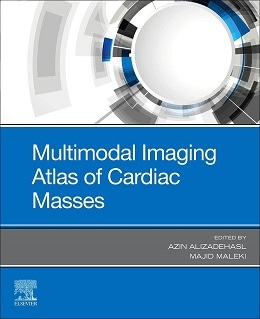 دانلود کتاب Multimodal Imaging Atlas of Cardiac Masses, 1ed