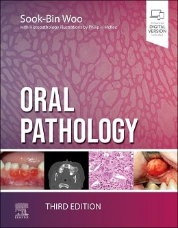 دانلود کتاب Oral Pathology, 3ed