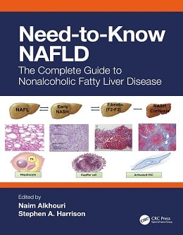 دانلود کتاب Need-to-Know NAFLD: The Complete Guide to Nonalcoholic Fatty Liver Disease, 1ed