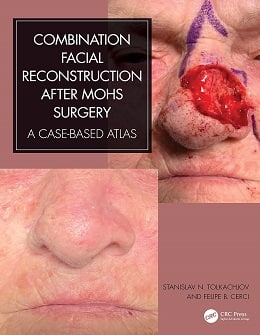 دانلود کتاب Combination Facial Reconstruction after Mohs Surgery, 1ed