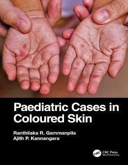 دانلود کتاب Paediatric Cases in Coloured Skin, 1ed
