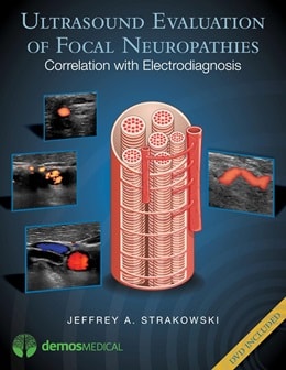 دانلود کتاب Ultrasound Evaluation of Focal Neuropathies: Correlation with Electrodiagnosis, 1ed