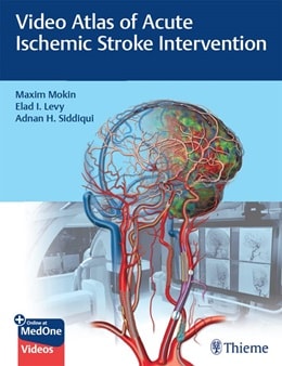 دانلود کتاب Video Atlas of Acute Ischemic Stroke Intervention, 1ed