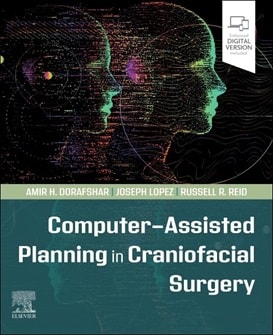 دانلود کتاب Computer-Assisted Planning in Craniofacial Surgery 1st Edition