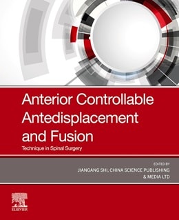 دانلود کتاب Anterior Controllable Antedisplacement and Fusion: Technique in Spinal Surgery, 1ed