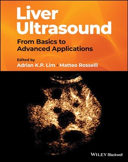 دانلود کتاب Liver Ultrasound: From Basics to Advanced Applications, 1ed