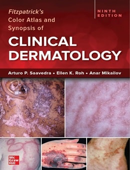 دانلود کتاب Fitzpatrick's Color Atlas and Synopsis of Clinical Dermatology 9th Edition