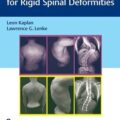 دانلود کتاب استئوتومی اصلاحی برای ناهنجاری های سخت ستون فقرات<br>Corrective Osteotomies for Rigid Spinal Deformities, 1ed