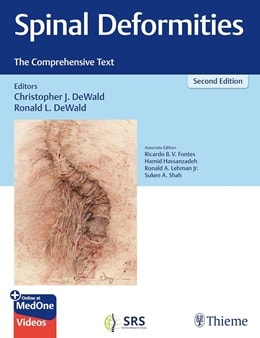 دانلود کتاب Spinal Deformities: The Comprehensive Text 2nd Edition