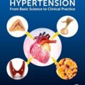 دانلود کتاب فشار خون غدد درون ریز: از علوم پایه تا عمل بالینی<br>Endocrine Hypertension: From Basic Science to Clinical Practice, 1ed