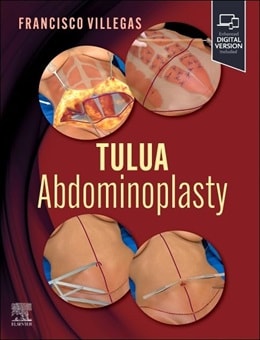 دانلود کتاب TULUA Abdominoplasty: Transverse Plication Technique 1st Edition