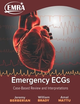 دانلود کتاب Emergency ECGs: Case-Based Review and Interpretations