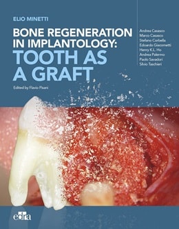 دانلود کتاب Bone Regeneration in Implantology: Tooth as a Graft, 1ed