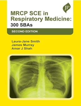 دانلود کتاب MRCP SCE in Respiratory Medicine: 300 SBAs, 2ed