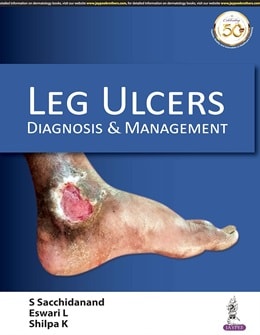 دانلود کتاب Leg Ulcers: Diagnosis and Management, 1ed