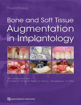 دانلود کتاب Bone and Soft Tissue Augmentation in Implantology 1st Edition