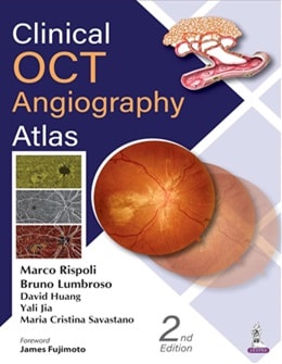 دانلود کتاب Clinical OCT Angiography Atlas 2nd Edition