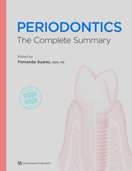 دانلود کتاب Periodontics: The Complete Summary 1st Edition