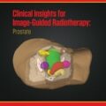 دانلود کتاب بینش بالینی برای رادیوتراپی هدایت شده با تصویر: پروستات<br>Clinical Insights for Image-Guided Radiotherapy: Prostate, 1ed