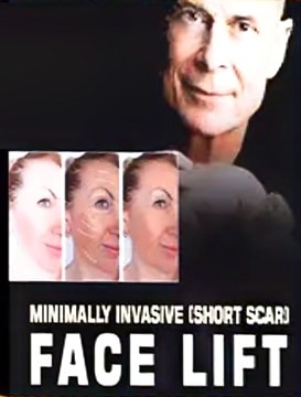 دانلود Minimally Invasive (Short Scar) Facelift By Dr.Joe Niamtu