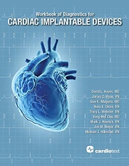 دانلود کتاب Workbook of Diagnostics for Cardiac Implantable Devices 1st Edition