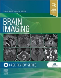 دانلود کتاب Brain Imaging: Case Review Series 3rd Edition