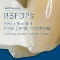 دانلود کتاب RBFDPs: پروتزهای دندانی ثابت متصل به رزین<br>RBFDPs: Resin-Bonded Fixed Dental Prostheses 1st Edition