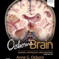 دانلود کتاب مغز آزبورن<br>Osborn's Brain 3rd Edition