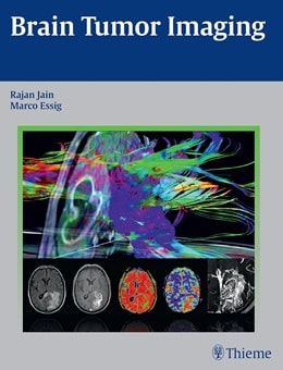 دانلود کتاب Brain Tumor Imaging 1st Edition