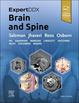 دانلود کتاب ExpertDDx: Brain and Spine 3rd Edition