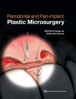 دانلود کتاب Periodontal and Peri-implant Plastic Microsurgery 1st Edition