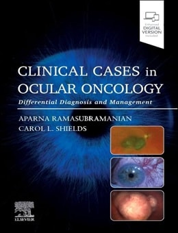 دانلود کتاب Clinical Cases in Ocular Oncology: Differential Diagnosis and Management 1st Edition