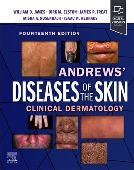 دانلود کتاب Andrews' Diseases of the Skin: Clinical Dermatology 14th Edition