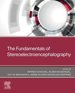 دانلود کتاب The Fundamentals of Stereoelectroencephalography 1st Edition