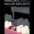 دانلود کتاب ایمپلنت مولار فوری<br>Immediate Molar Implants 1st Edition